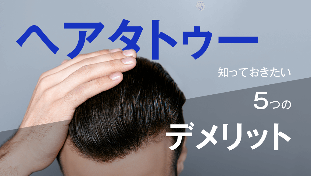 ヘアタトゥーで失敗 後悔しないために知っておきたい5つのデメリット あんしん通販マートのwebマガジン