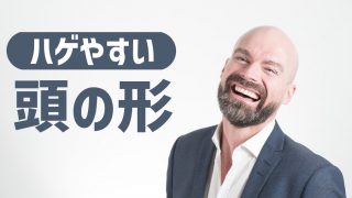 生まれつきのm字ハゲは存在しない 富士額でもハゲやすいわけではない あんしん通販マートのwebマガジン