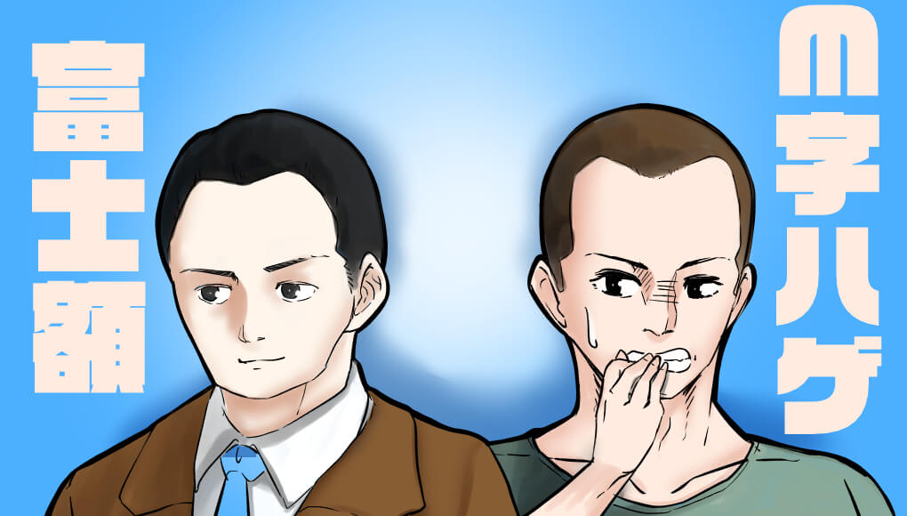 生まれつきのm字ハゲは存在しない 富士額でもハゲやすいわけではない あんしん通販マートのwebマガジン